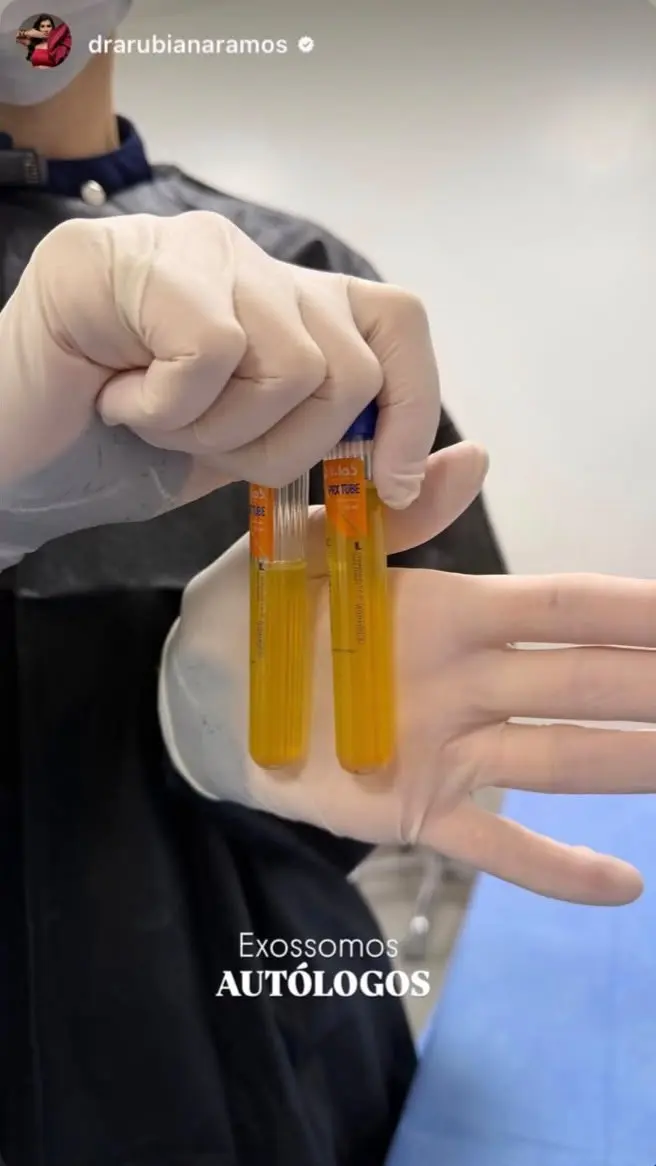 Tubos com plasma enriquecido em ambiente clínico