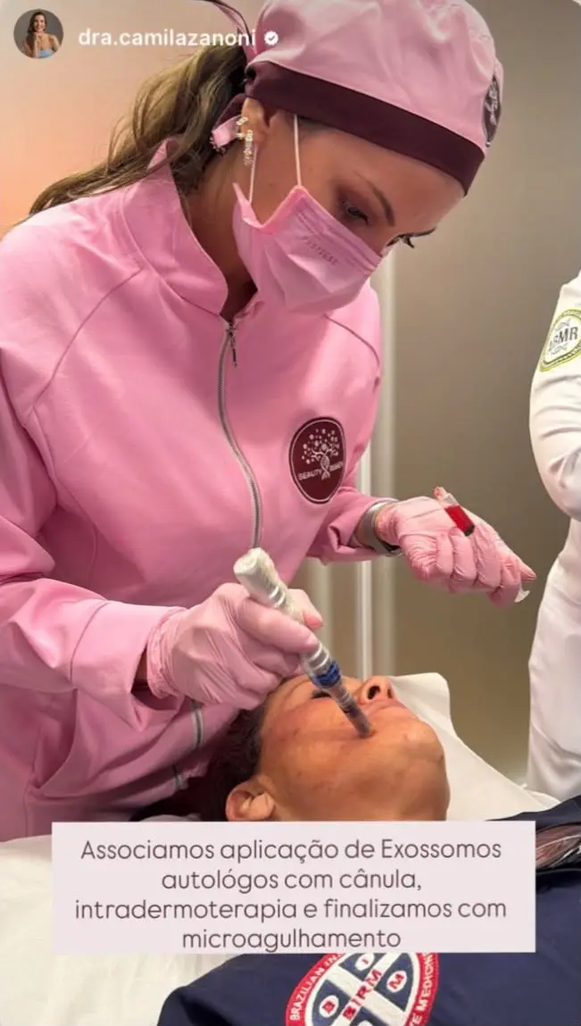 Aplicação médica dentro de protocolo com exossomos autólogos